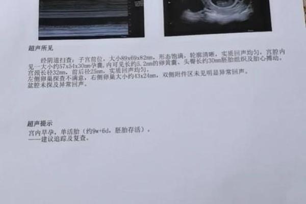 孕妇梦见吃西瓜是胎梦吗风水解答