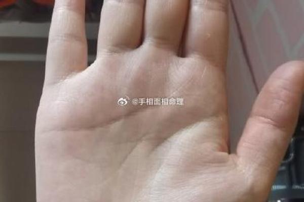 去算命回来就发烧了