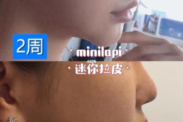 下巴八字纹