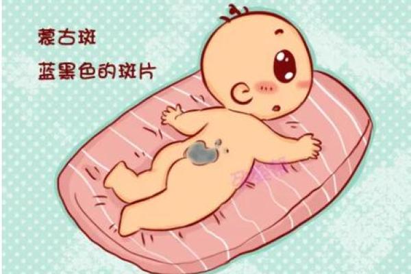 脖子上的胎记如何算命-