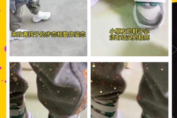 儿童内八字