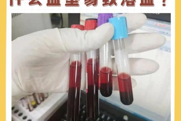 孕妇为什么要检查血型