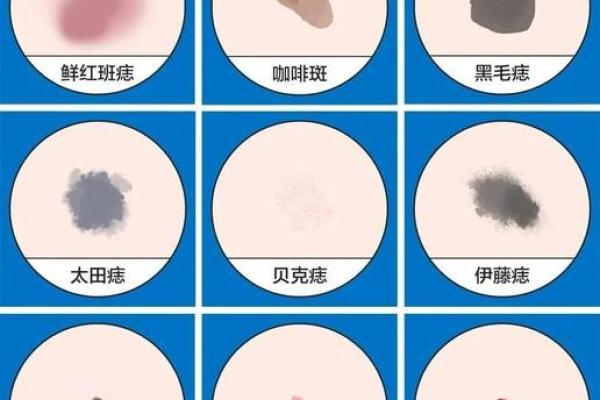 胎记的位置与算命图解