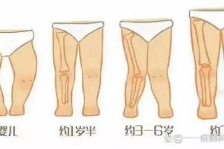 外八字危害