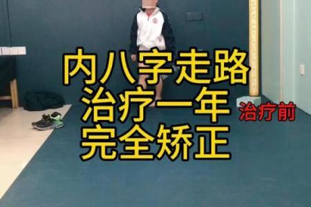 怎样纠正内八字,14岁内八字怎么矫正最快