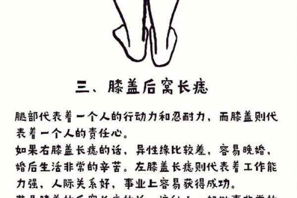 痣相风水脚底有痣的人命运好不好