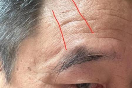 眉间八字纹，眉间两道竖纹代表什么