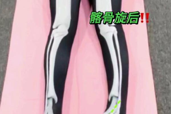 如何纠正内八字脚