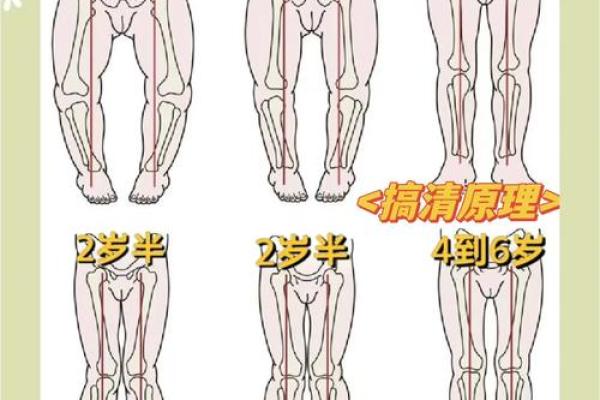 如何纠正内八字脚