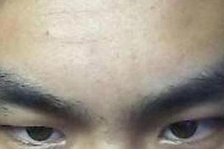 眉头有八字印预示什么？如何化解眉头八字印带来的影响？