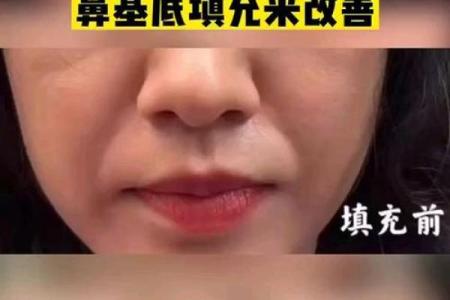鼻子八字型特征及处理技巧！