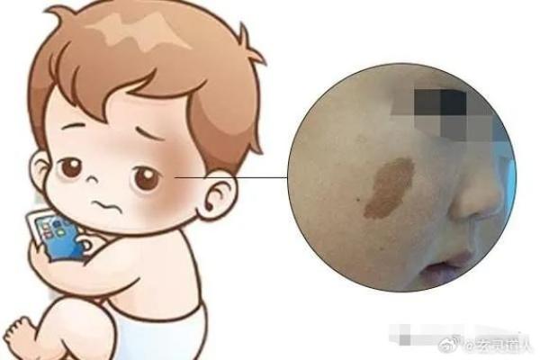身上胎记算命图解