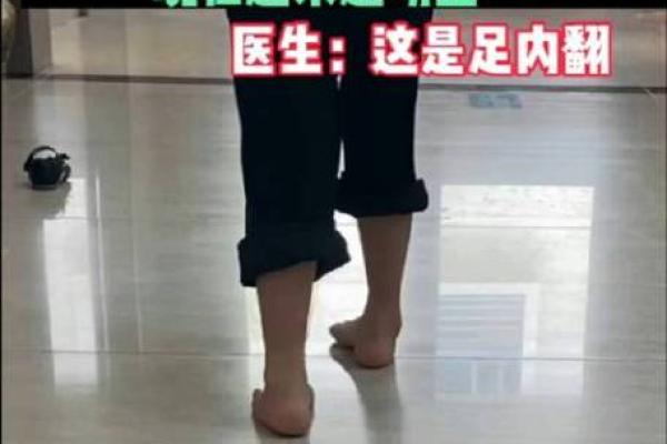 内八字脚