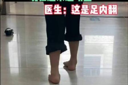 内八字脚