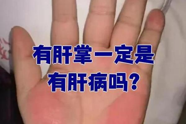 朱砂掌算命，手掌红就是朱砂掌吗？