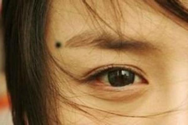 眼睛上的胎记算命分析