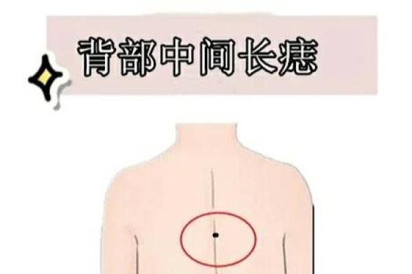 女人背部痣相图解算命