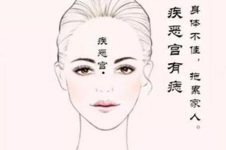 详解胎记算命