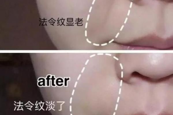 八字皱纹