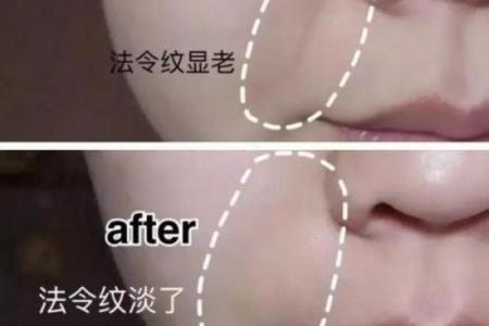 八字皱纹