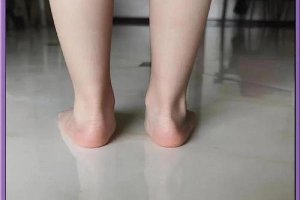 外八字性格